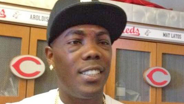 Cincinnati Reds' reliever Aroldis Chapman was back at the team's spring training camp just four days after being hit in the face with a line drive that forced him to undergo surgery for several fractures and a broken nose. (Courtesy the Cincinnati Reds.com)
